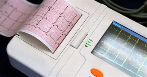 Procurement of an Electrocardiogram (ECG) Machine for Al-Safoula Charitable Medical Center